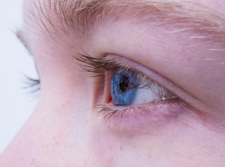 Ожог роговицы глаза: лечение и первая помощь